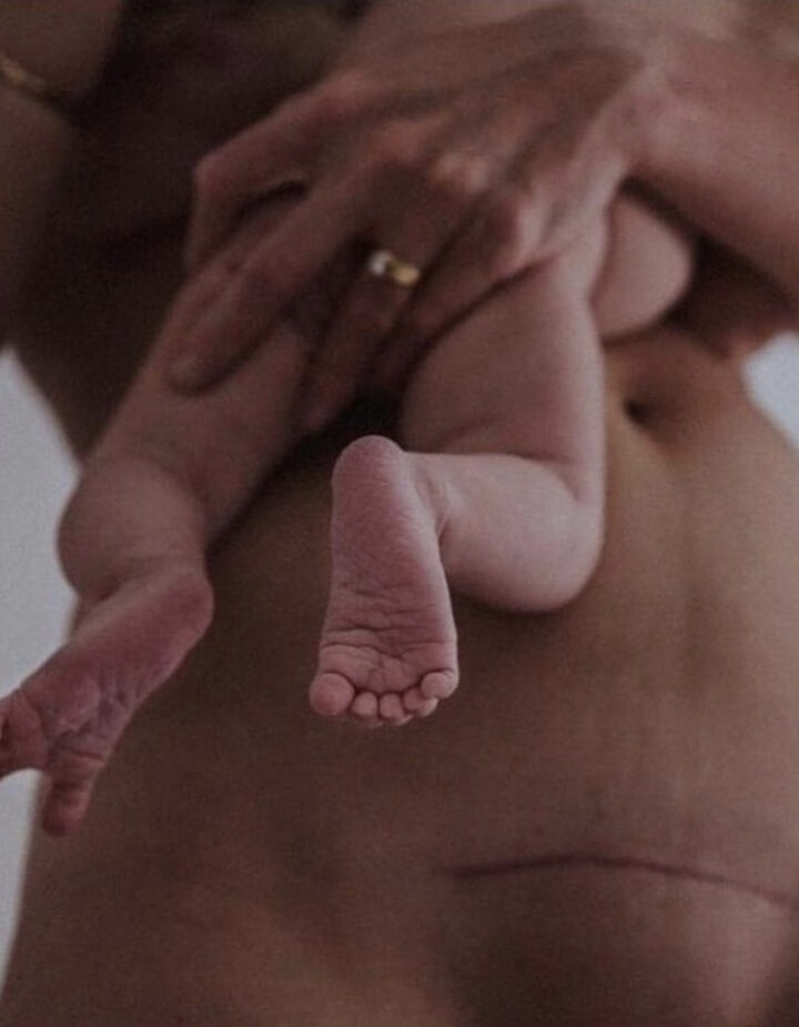 Woman with c-section scar holding a newborn